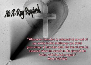 Read more about the article No X-Ray Required